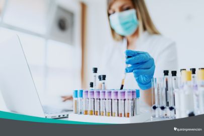 mujer manipulando vacunas en laboratorio imagen pequeña