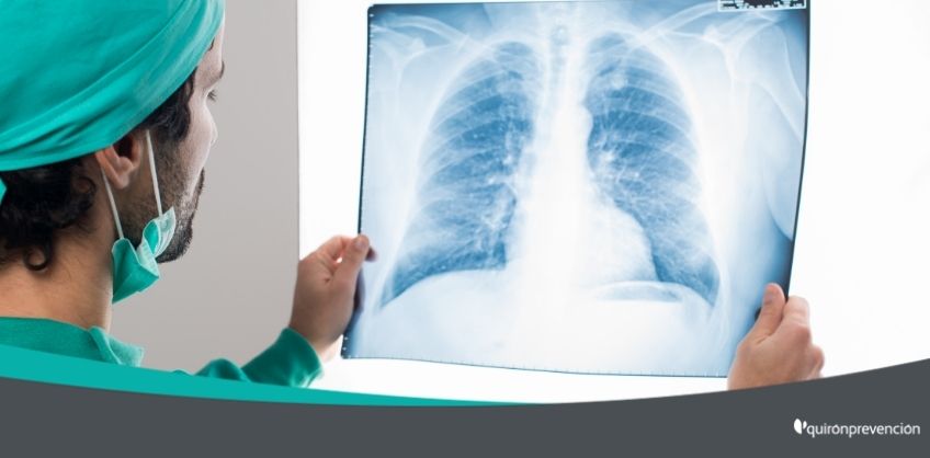 médico viendo radiografía imagen grande
