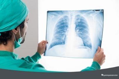 médico viendo radiografía imagen pequeña